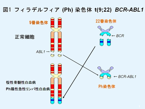 性 白血病 骨髄 原因 急性