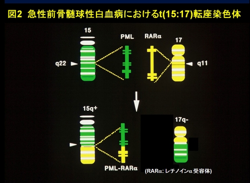 図2　急性前骨髄球性白血病におけるt(15:17)転座染色体