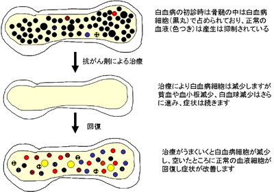 化学療法 図5